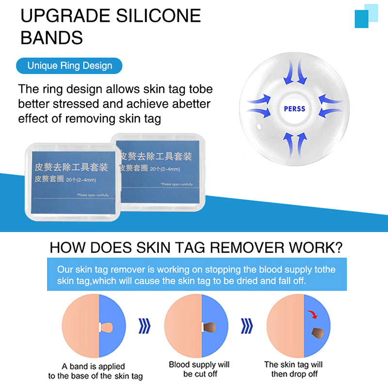 20pcs/Box Flesh Nevus Removal  - đánh giá và giá Electro Gadgets