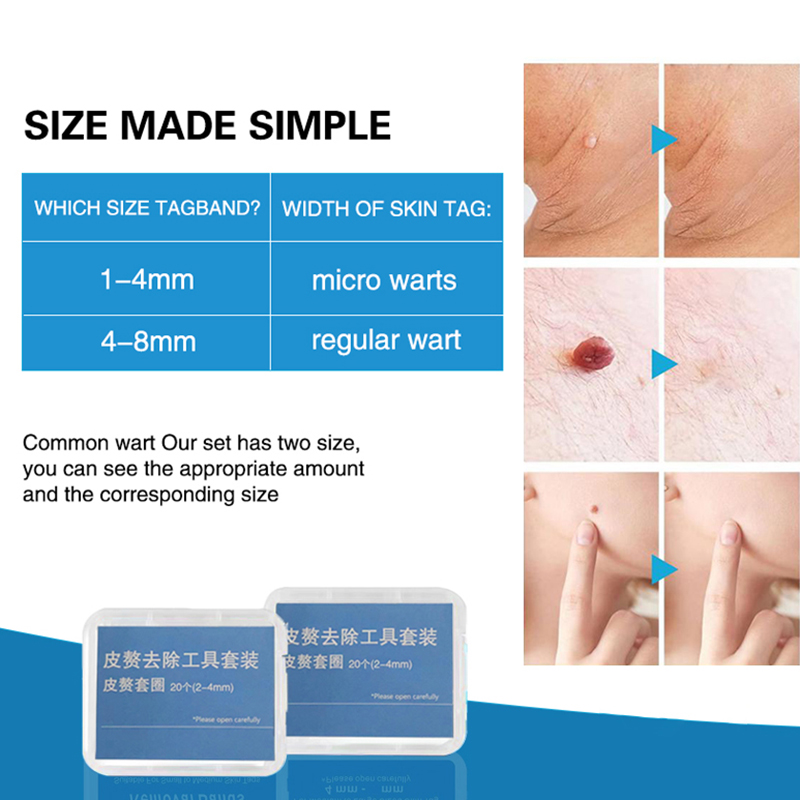 20pcs/Box Flesh Nevus Removal  - đánh giá và giá Electro Gadgets